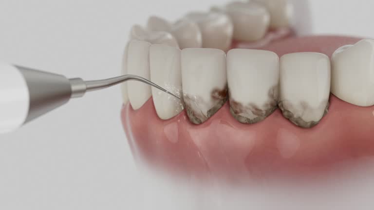 Trusted Teeth Cleaning And Checkup service in Twinsburg Heights, OH - Dentist Open Now